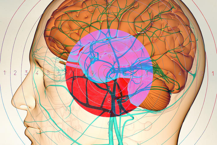 Illustration of the profile of a head with a colorfully drawn brain and nerves, overlaid with a pink and red bullseye. 